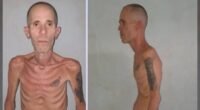 Ex-prisioneiro político cubano libertado em estado de saúde extremamente grave causa revolta internacional