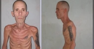 Ex-prisioneiro político cubano libertado em estado de saúde extremamente grave causa revolta internacional