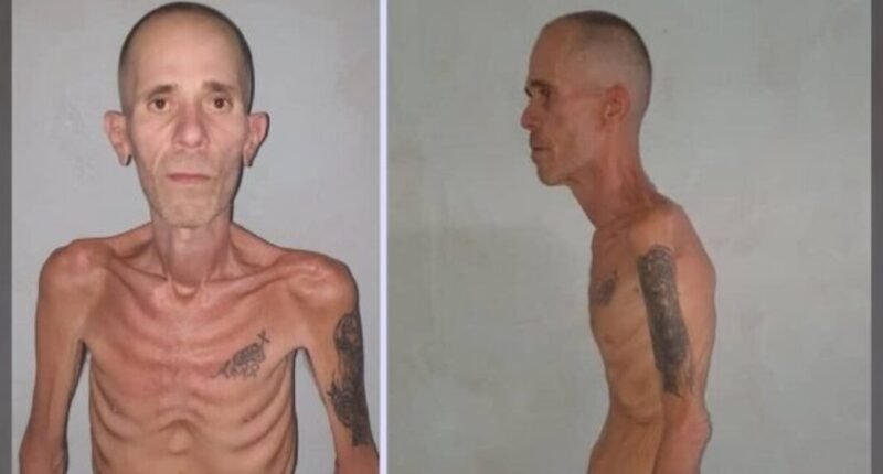 Ex-prisioneiro político cubano libertado em estado de saúde extremamente grave causa revolta internacional